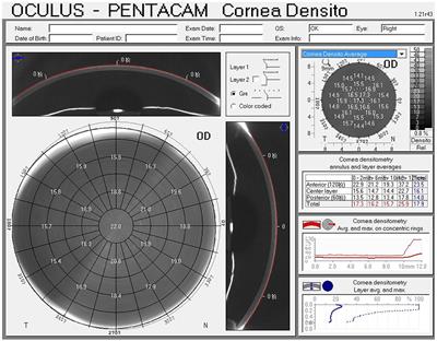 Corneal Densitometry After Small Incision Lenticule Extraction (SMILE) and Femtosecond Laser-Assisted LASIK (FS-LASIK): 5-Year Prospective Comparative Study